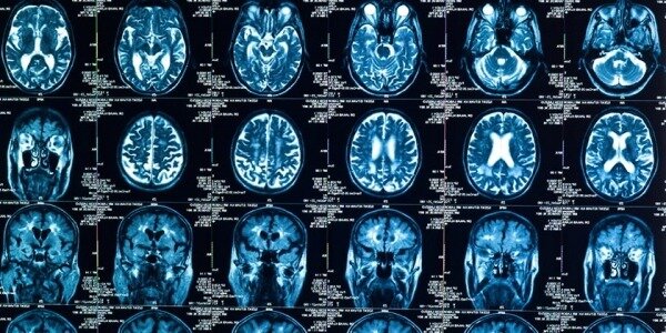 Ученые доказали, что наш мозг может нагреваться до 40 градусов и выше1